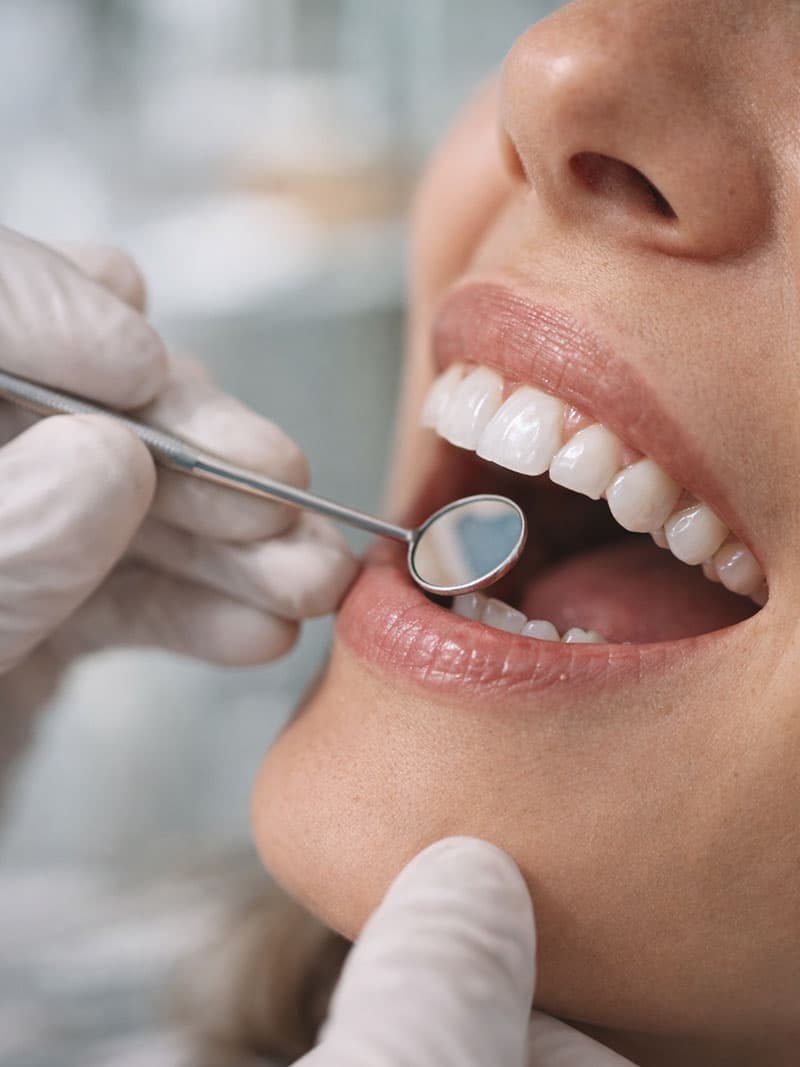dental inspection