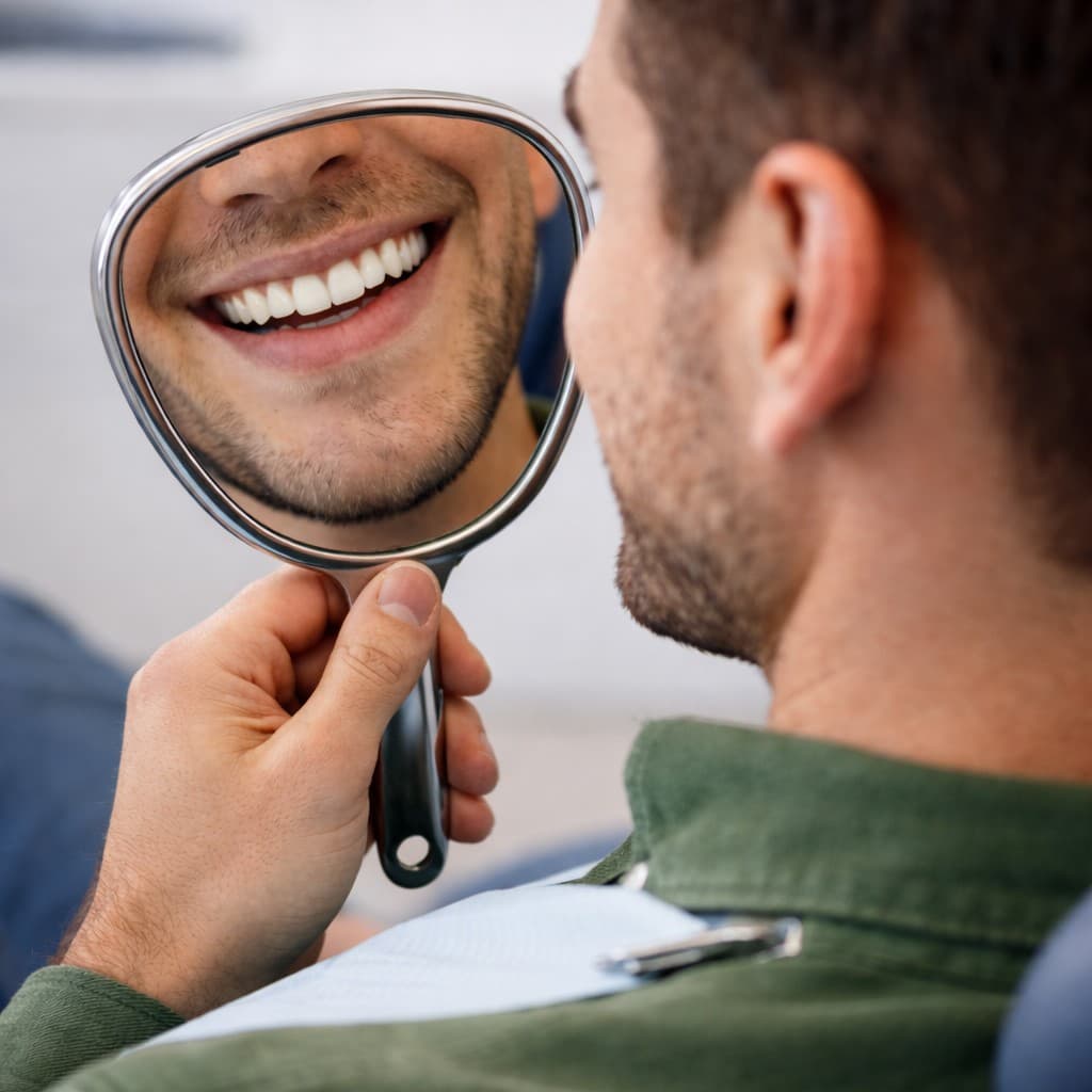 Dental veneers